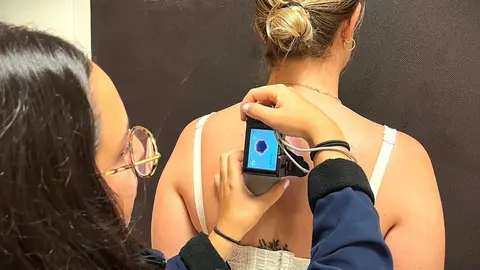 Toma de imagen de dermatología.